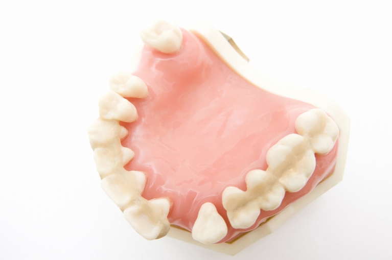 歯の土台を弱らせる「歯周病」を治療・予防